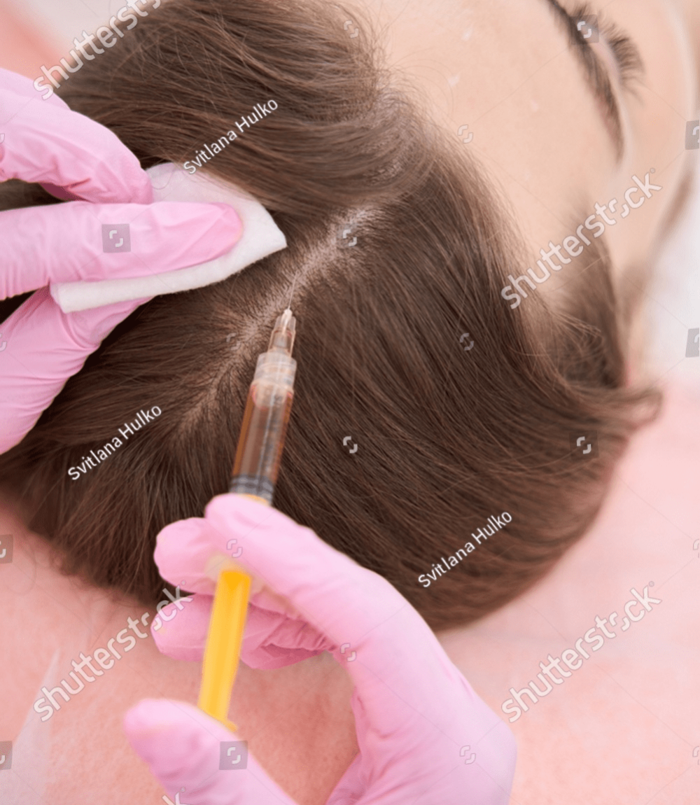 stock-photo-syringe-is-injected-subcutaneously-on-the-skin-of-a-head-2182245069 1